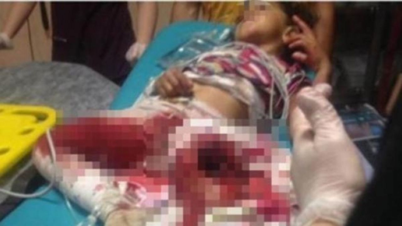 5 yaşındaki kız çocuğu patos makinesine takılarak yaralandı