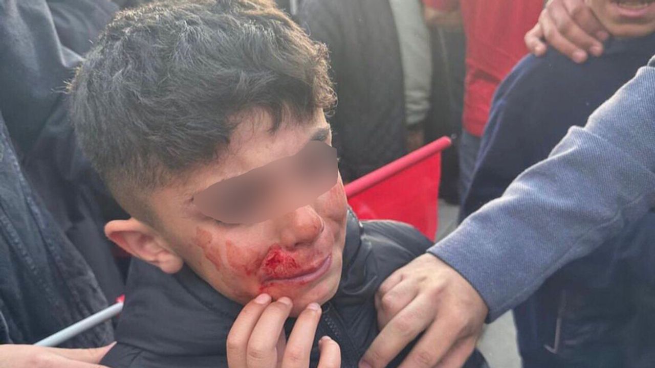 Erzurum’da Ekrem İmamoğlu mitingine taşlı saldırı; Çocuklar yaralandı