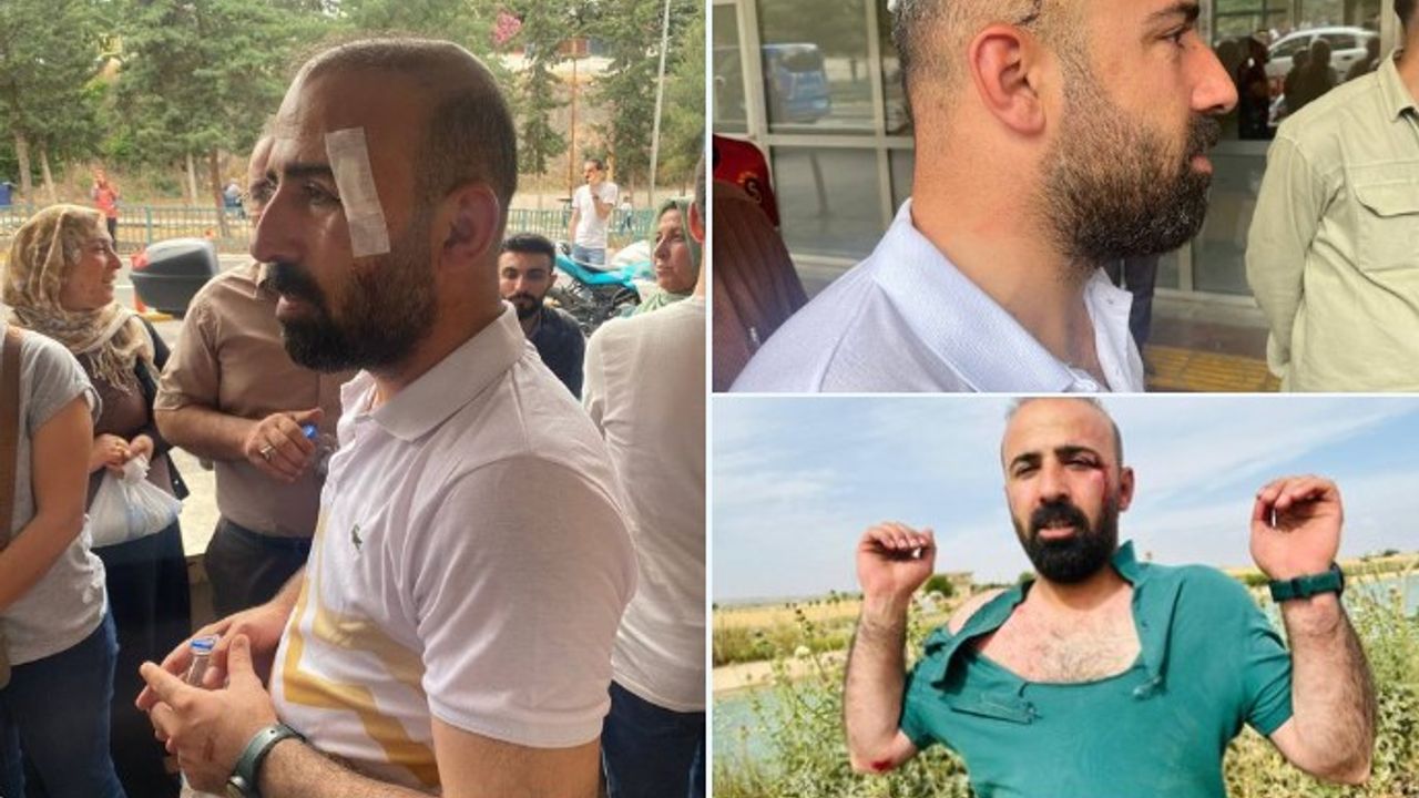 Şanlıurfa'da HDP'li sandık görevlilerine saldırı: İl Eş Başkanı da dahil 6 kişi yaralandı