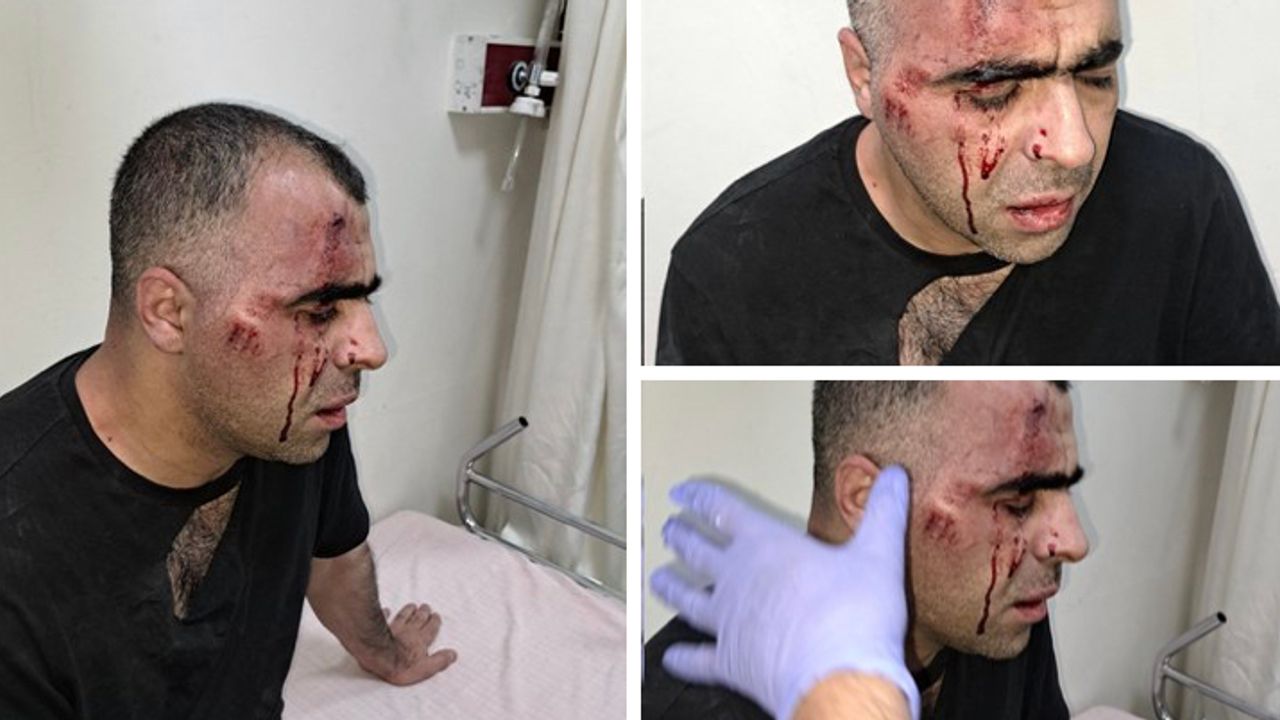Gazeteci Sinan Aygül’e saldıran Tatvan Belediye Başkanı korumaları tutuklandı