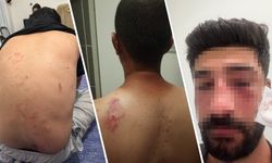 Mersin’de Kürt aileye ırkçı saldırı
