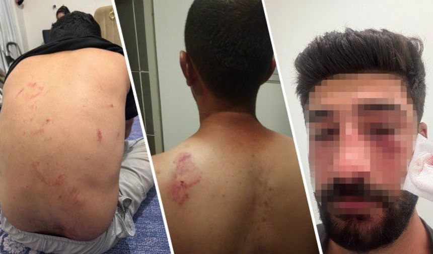 Mersin’de Kürt aileye ırkçı saldırı